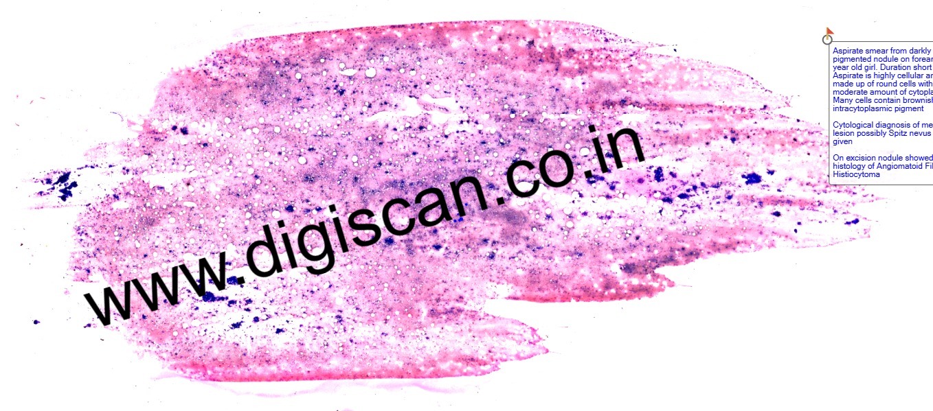 Fine Needle Aspiration Cytology (FNAC) Digital Slides Set